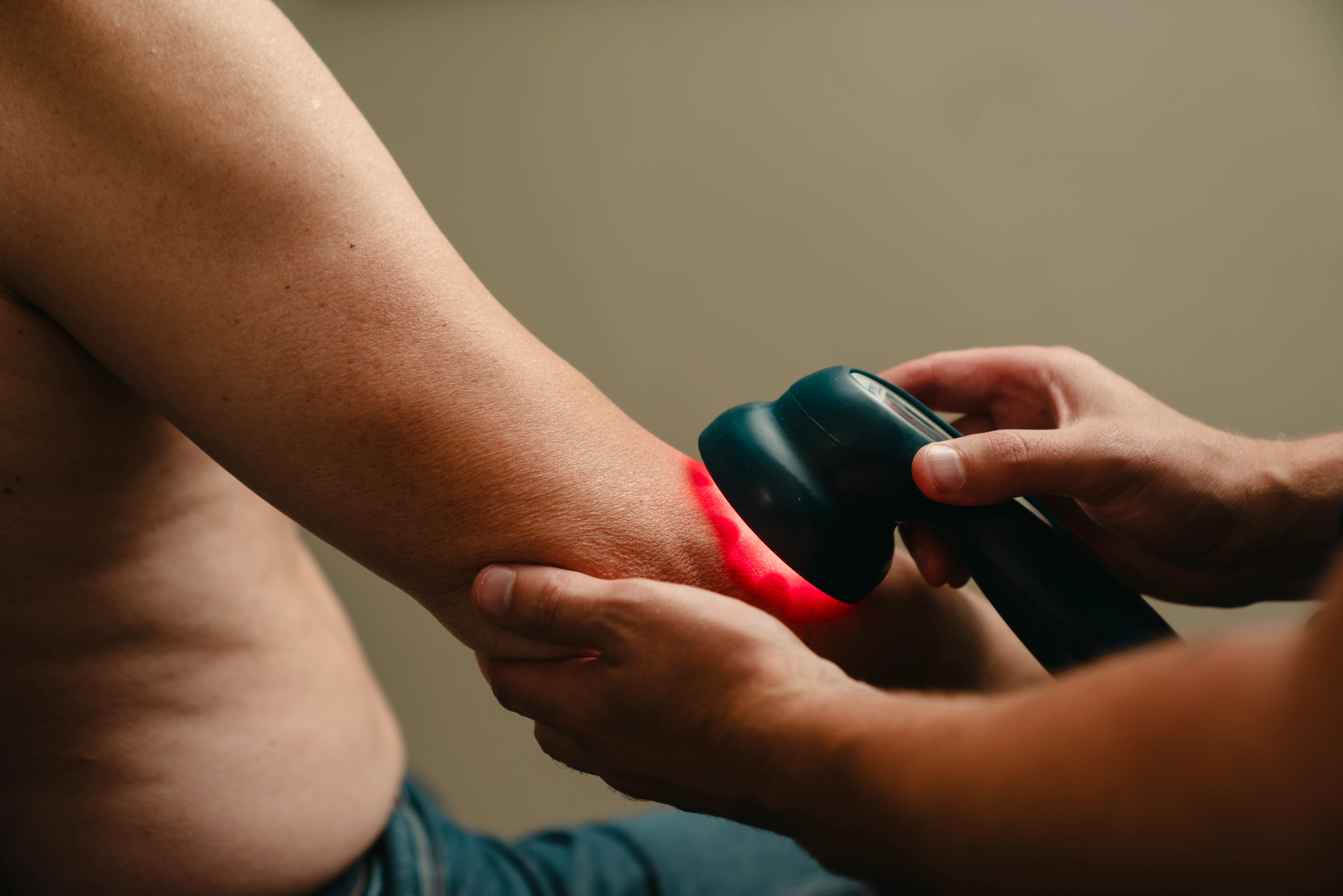 Lavnivå laserbehandling av albue – LLLT for tennisalbue og seneplager